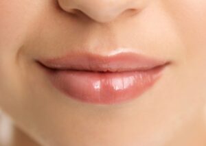 Top Cosmetic Clinics for Lip Reduction in Islamabad