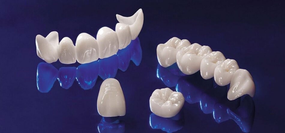 Dental Crowns and Bridges in Dubai
