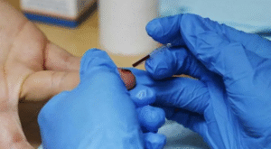 STD Test in Dubai Support Groups: Community Resources