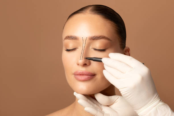 Rhinoplasty: Myths and Facts You Should Know