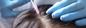 تعرف على أسعار زراعة الشعر في الرياض وأفضل العروض المتاحة