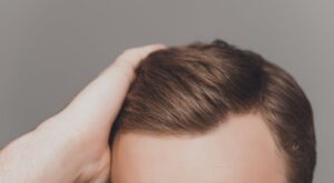 Front Line Hair Fixing