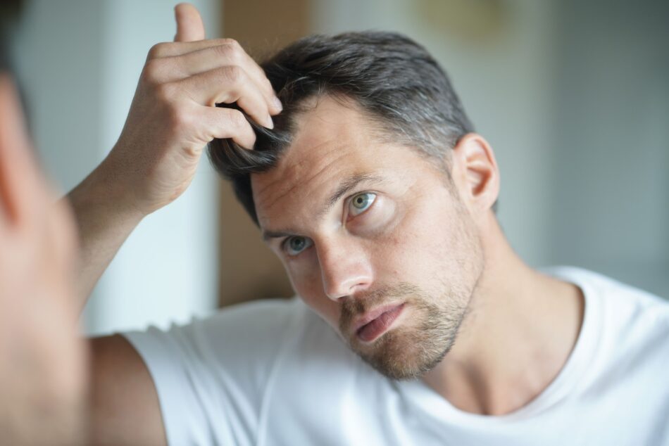 Finasteride 1mg Price in UAE