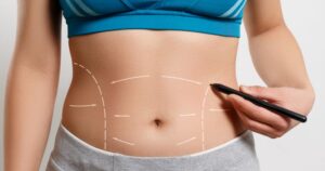 Can a Tummy Tuck Fix Loose Skin After Weight Loss Safely?
