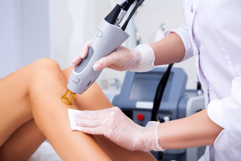 Laser Stretch Marks Treatment in Dubai