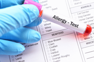Allergy Blood Test