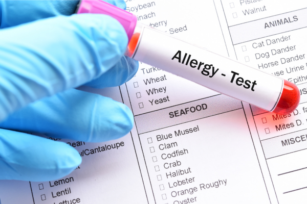 Allergy Blood Test