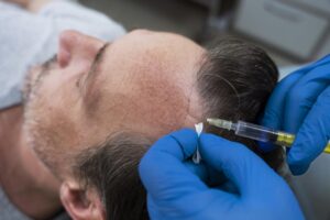 Proven Benefits of Visiting a Hair Specialist Doctor for Hair Restoration