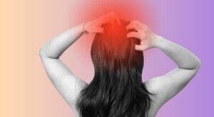 Can a dermatologist treat scalp eczema for fast relief