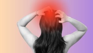 Can a dermatologist treat scalp eczema for fast relief