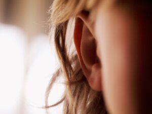 Ear Reshaping: Essential Pre-Surgery Tips for Best Outcomes
