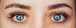 Upper vs Lower Eyelid Surgery in Riyadh: Which One Do You Need?