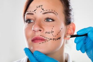 Facelift Surgery: Smooth Fine Lines and Wrinkles