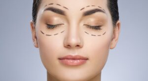 Fotona 4D Facelift Treatment: Natural Facial Contouring Benefits