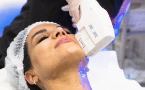 What to Expect When You Tighten Skin with HIFU Treatment Safely