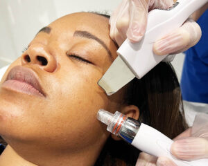 Hydrafacial for Sensitive Skin: Safe and Soothing Glow Solution