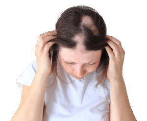 Is Scalp Micropigmentation a Good Option for Alopecia Areata in Dubai?