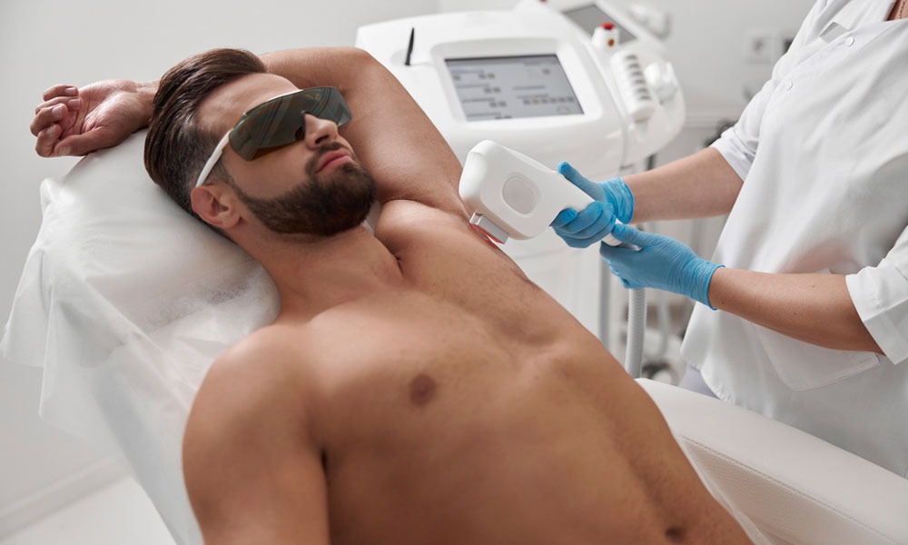 Male Laser Hair Removal