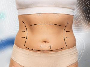 Liposuction: Sculpt Your Body with Precision and Safety