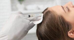 Best PRP Hair Treatment