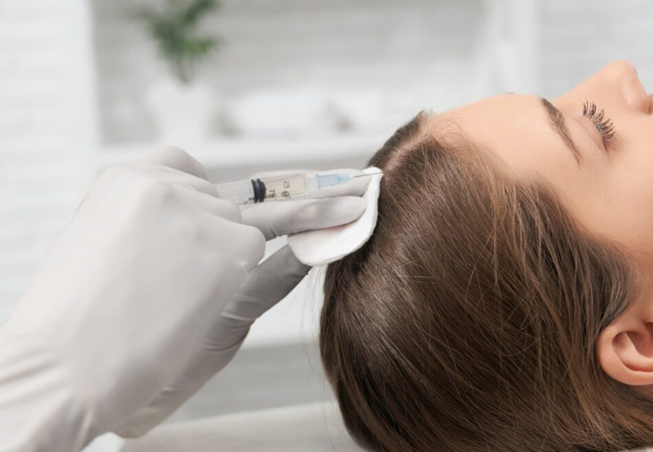 Best PRP Hair Treatment