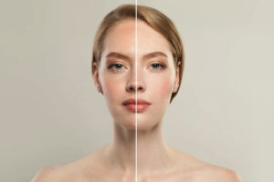 Pigmentation Treatment: Avoid These Common Mistakes