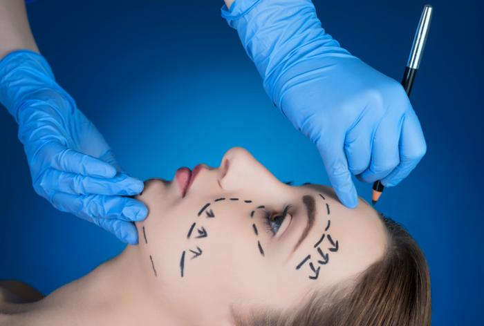 Rediscover Confidence Through Facelift Surgery