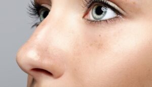 Rhinoplasty: Correct and Reshape Your Nose Naturally