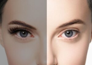 Skin Whitening Techniques That Fit Busy Lifestyles