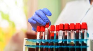 Blood Test at Home for Endurance Athletes