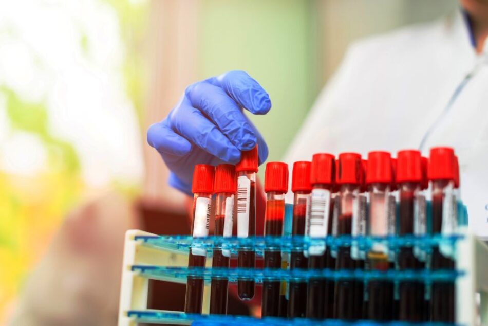 Blood Test at Home for Endurance Athletes