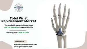 Total Wrist Replacement Market Size, Trends and Analysis 2034