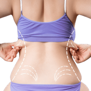 What Is the Difference Between Traditional and Laser-Assisted Abdominal Liposuction in Dubai?