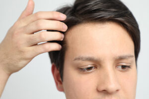 Hair Transplant Guide to Achieve Stronger and Thicker Hair for Life