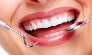 Benefits Of Visiting A Qualified Cosmetic Dentist