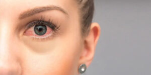 Blurry Vision Warning Signs: When to Consult the Best Cataract Surgeon