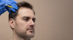 Hair Loss Treatment