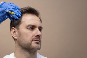 Hair Loss Treatment