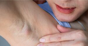 Expert Tips for Achieving Smooth Skin with Underarm Whitening Treatment