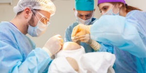 is hair transplant permanent or temporary