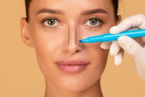 Why Customized Rhinoplasty Surgery Plans Are Crucial