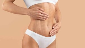 Best Doctors in Dubai: Transforming Body Contouring Through Fat Transfer