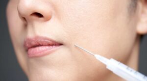 Permanent skin whitening injection price in Dubai