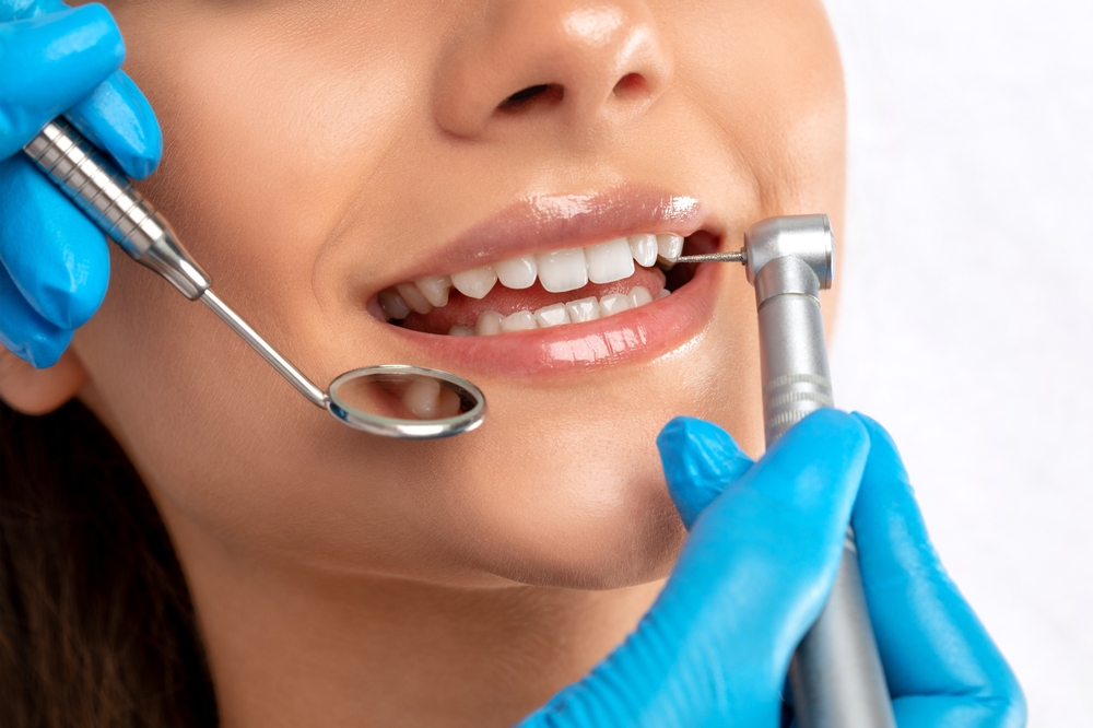 Tooth Filling Cost in Dubai