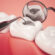 Tooth Filling Cost in Dubai
