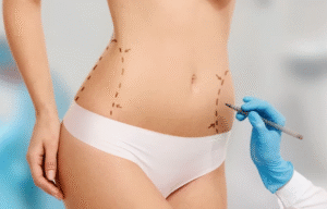 How to Get Maximum Results with a Safe Tummy Tuck