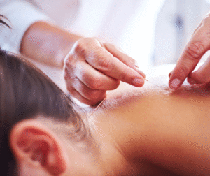 Descubriendo el Bienestar: Los Beneficios de la Acupuntura Médica Explicados