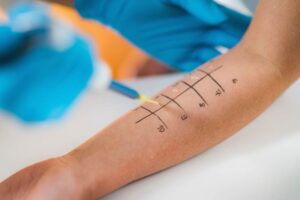 Allergy Testing: Identify Triggers and Take Control of Your Health
