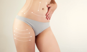 Surgical Truths Unveiled by Best Liposuction Surgeon in Dubai