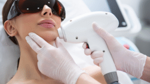 Can Laser Hair Removal Be Done on Facial Hair?